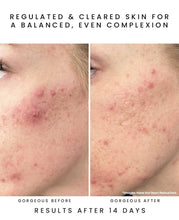Load image into Gallery viewer, Glow Juice 10-Acid Refining Peel
