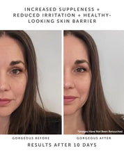 Load image into Gallery viewer, Horizon Ceramide Repair Serum
